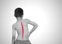 4 Best Mattress for Scoliosis in 2024