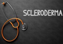 PEMF Therapy and Scleroderma
