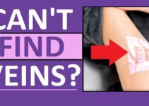 Here’s What to Do if You Can’t Find a Vein