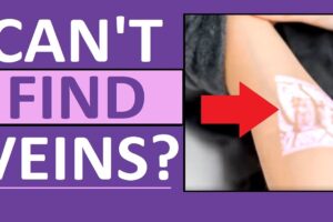 Here’s What to Do if You Can’t Find a Vein