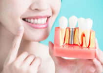 Dental Billing Services: Simplifying the Financial Side of Your Practice