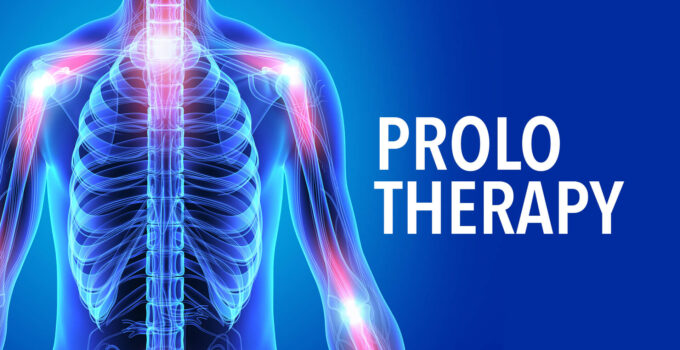 How Long Does it Take for Prolotherapy to Work?
