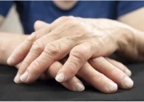 The Different Types of Arthritis, Self Care, and Medical Intervention