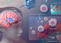 The Future Of Glioblastoma Treatment: A Promising Horizon For Patients