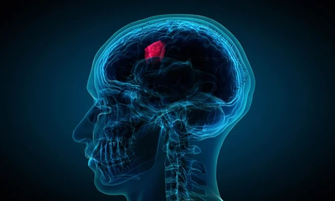 Quality of Life for Glioblastoma Patients